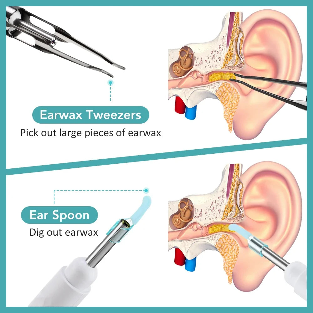 Smart Visual Ear Wax Removal Tool with HD Camera