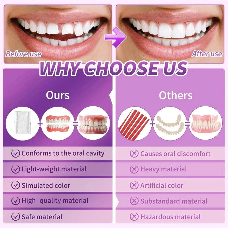 Comfortable Silicone Denture Set for Instant Smile Transformation - 9