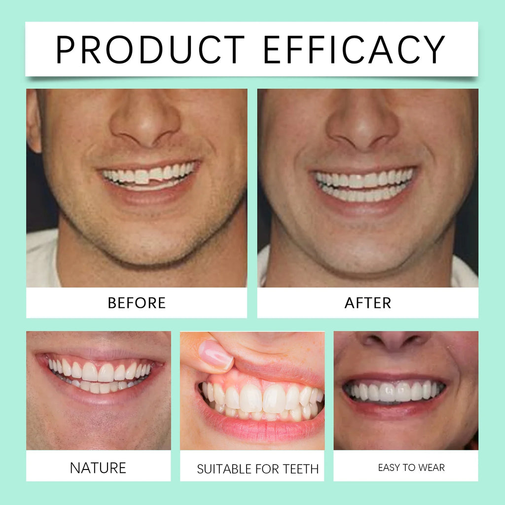 Flexible Cosmetic Silicone Denture Set for Instant Smile