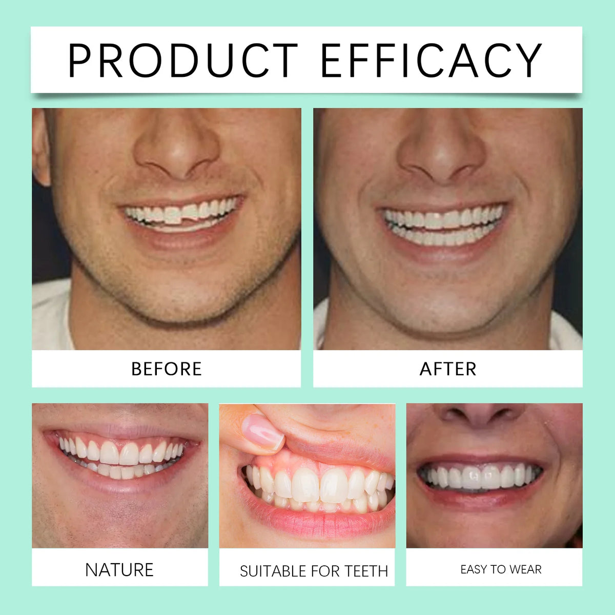 Flexible Cosmetic Silicone Denture Set for Instant Smile