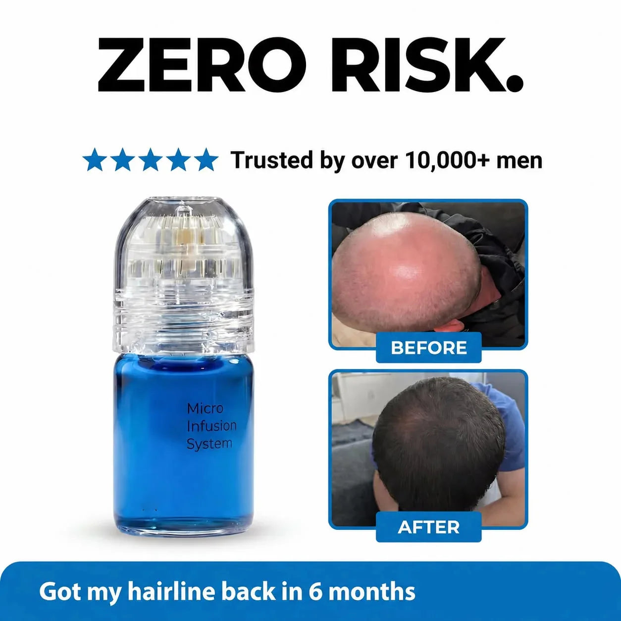Microneedle Hair Regrowth and Scalp Nourishing Serum Kit - 2