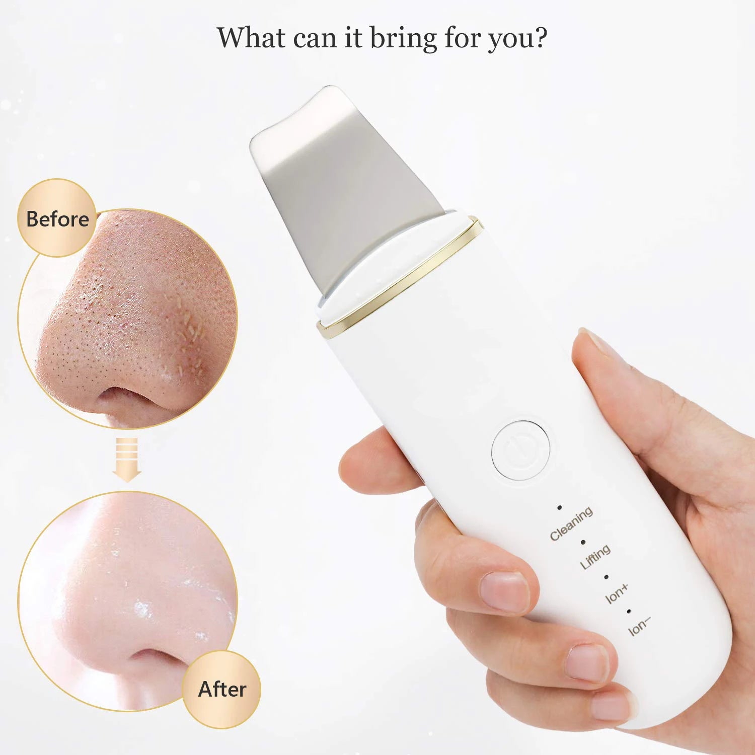 Ultrasonic Facial Skin Scrubber and Pore Cleanser - 4