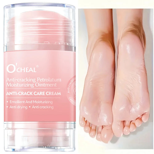 Anti-Crack Moisturizing Cream for Dry Hands and Cracked Heels