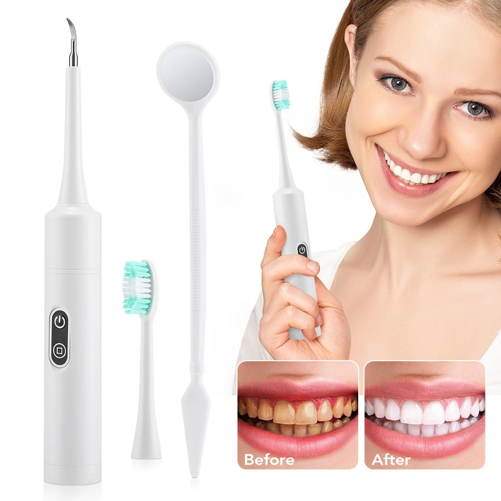 Electric Sonic Dental Scaler and Tartar Remover for Home Use - 7