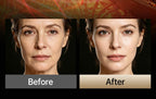 LED Facial Sculpting and Skin Tightening Device