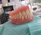 Realistic Cosmetic Smile Veneers for Daily Wear