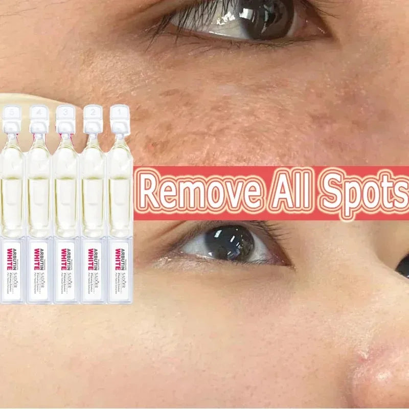 Brightening Niacinamide Facial Serum for Even Skin Tone