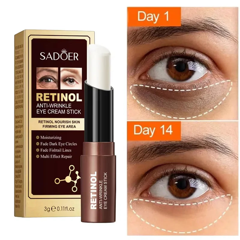 Retinol Anti-Wrinkle Eye Cream Stick for Dark Circles - 1