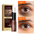 Retinol Anti-Wrinkle Eye Cream Stick for Dark Circles