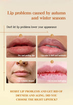 12-Piece Fruity Moisturizing Lip Balm Set for Dry Lips
