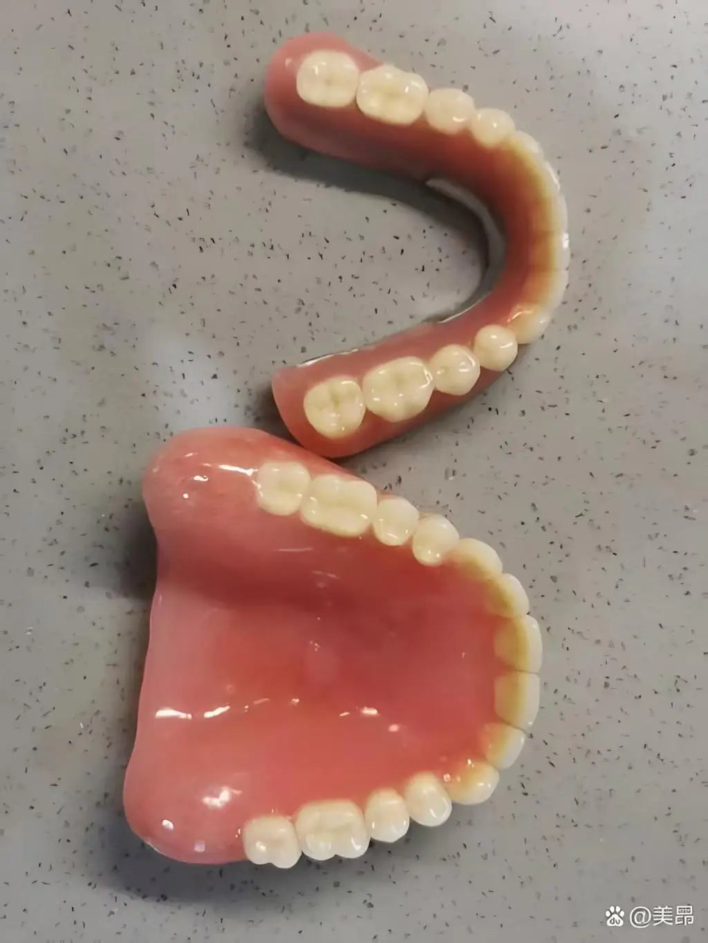 Realistic Cosmetic Smile Veneers for Daily Wear - 8