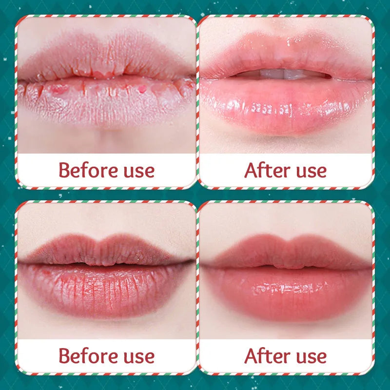 Hydrating Moisturizing Lip Balm Set for Dry Cracked Lips