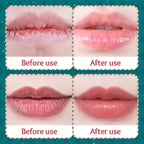 Hydrating Moisturizing Lip Balm Set for Dry Cracked Lips