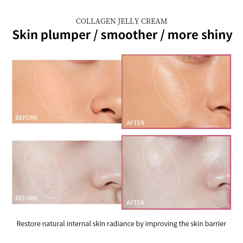 Collagen Jelly Cream for Deep Hydration and Skin Firming - 11