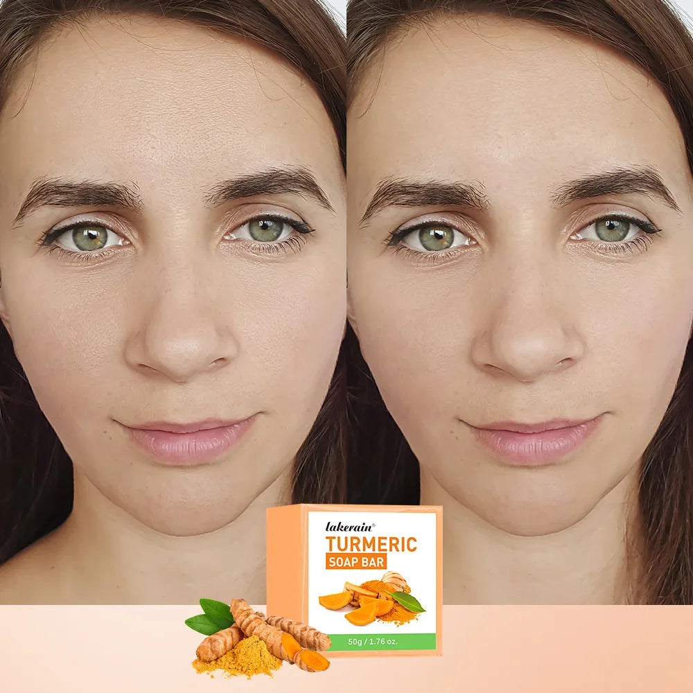 Turmeric Brightening Soap Bar for Face and Body