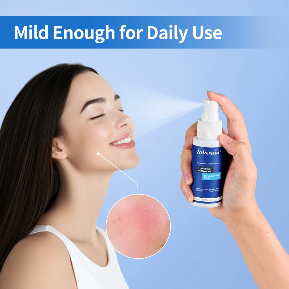Hypochlorous Acid Soothing Facial Mist for Acne and Redness - 1